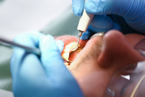 Best Emergency Root Canal Therapy in Keokea, HI